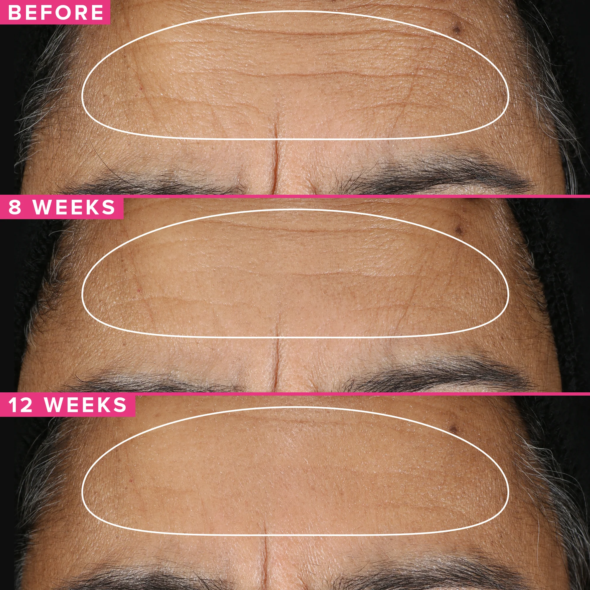 1% Vitamin A Retinol Serum Trial Size - Image 5