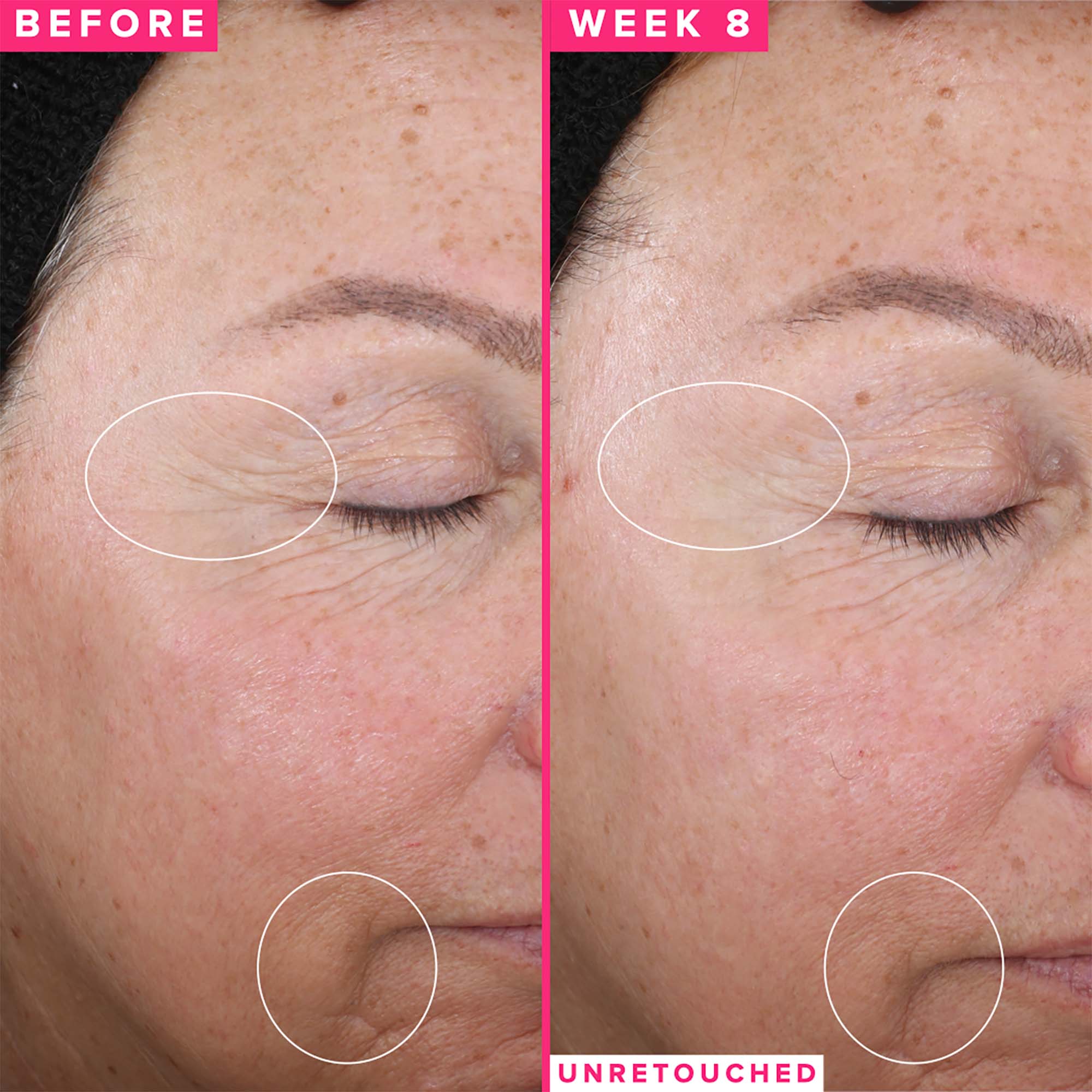 1% Vitamin A Retinol Serum Gift ($62 Value) - Image 5